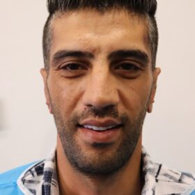 اتوپلاستی برای بزرگسالان چه انتظاراتی داشته باشیم