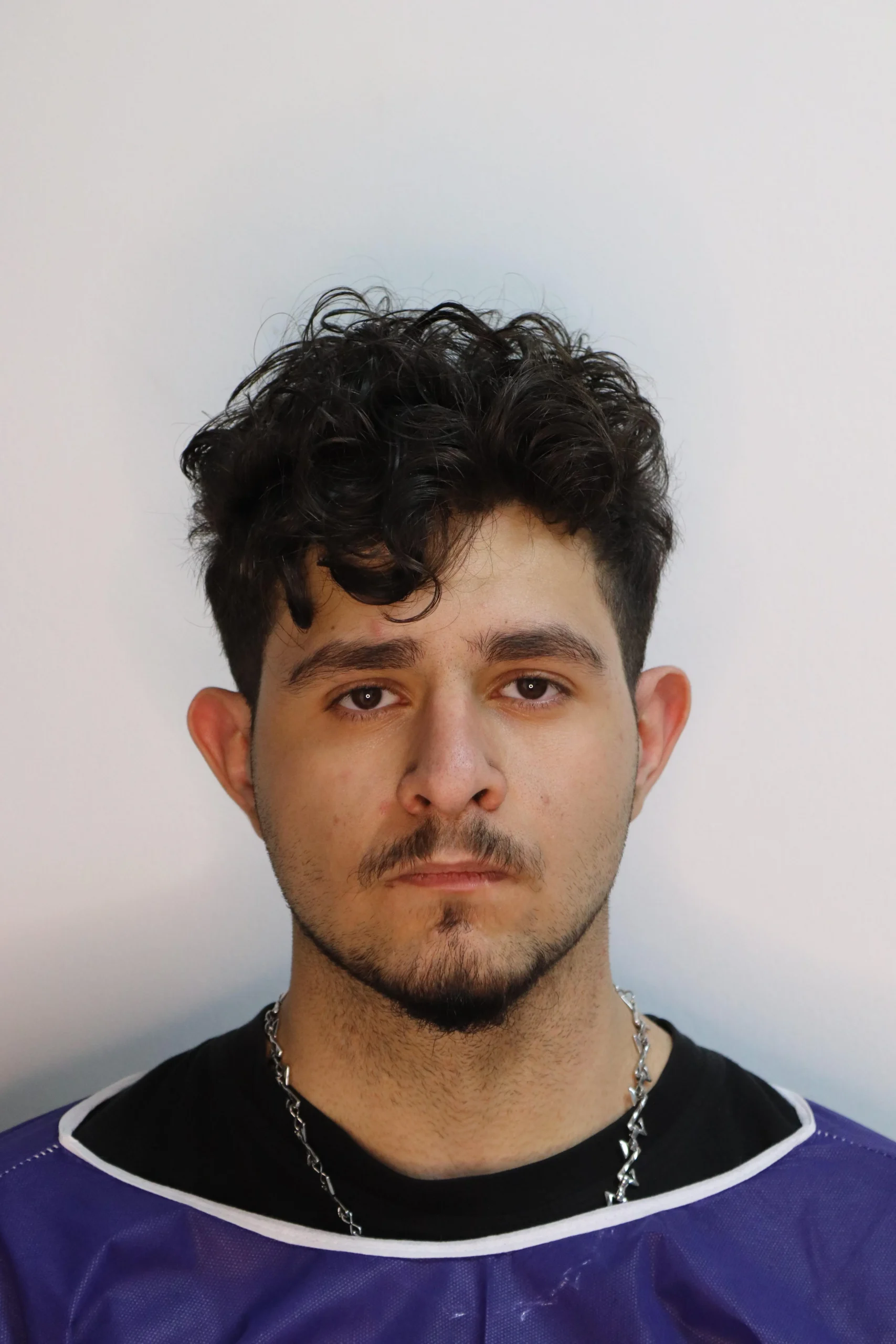 جراحی زیبایی گوش قبل از عمل