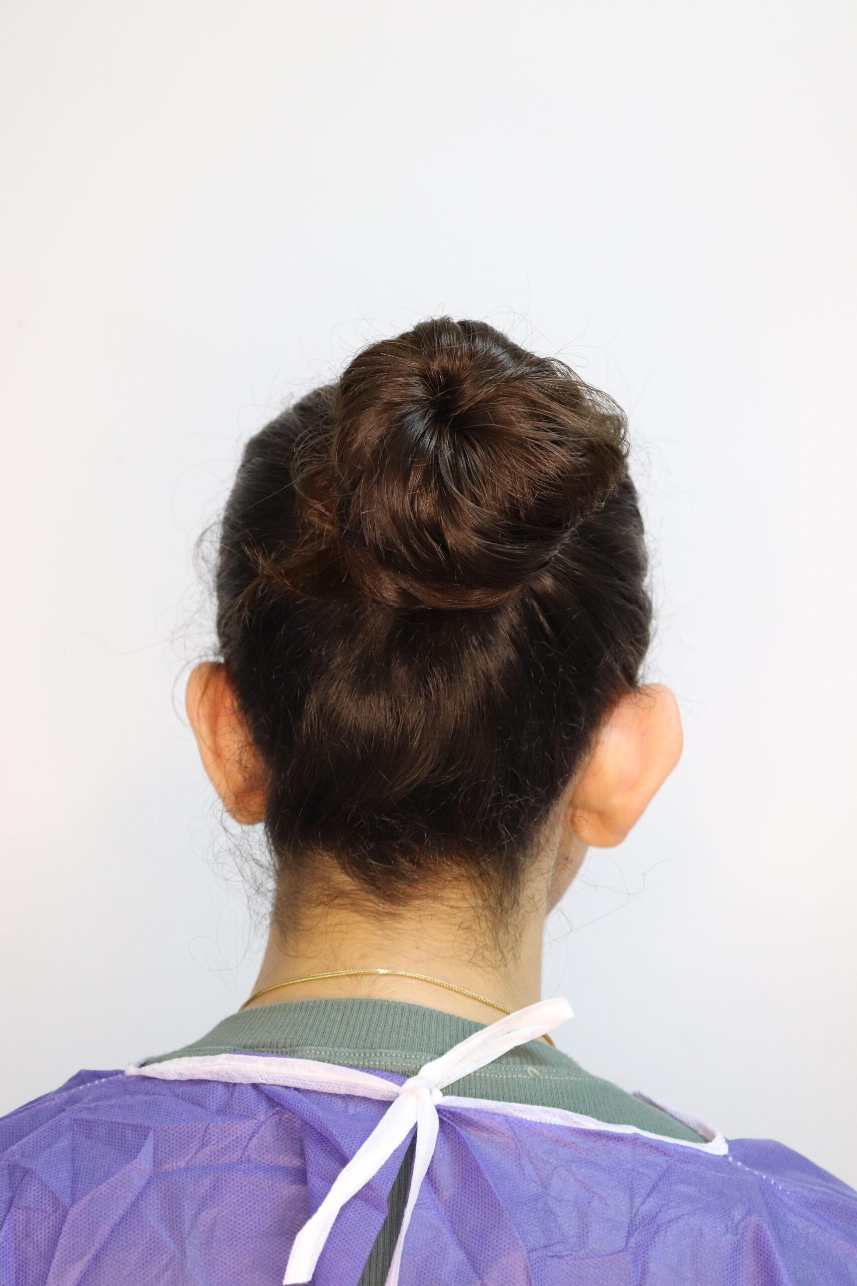 جراحی زیبایی گوش قبل از عمل