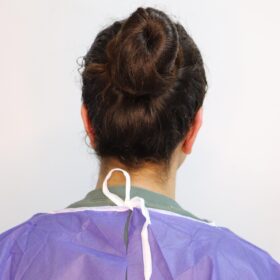 جراحی زیبایی گوش بعد از عمل 