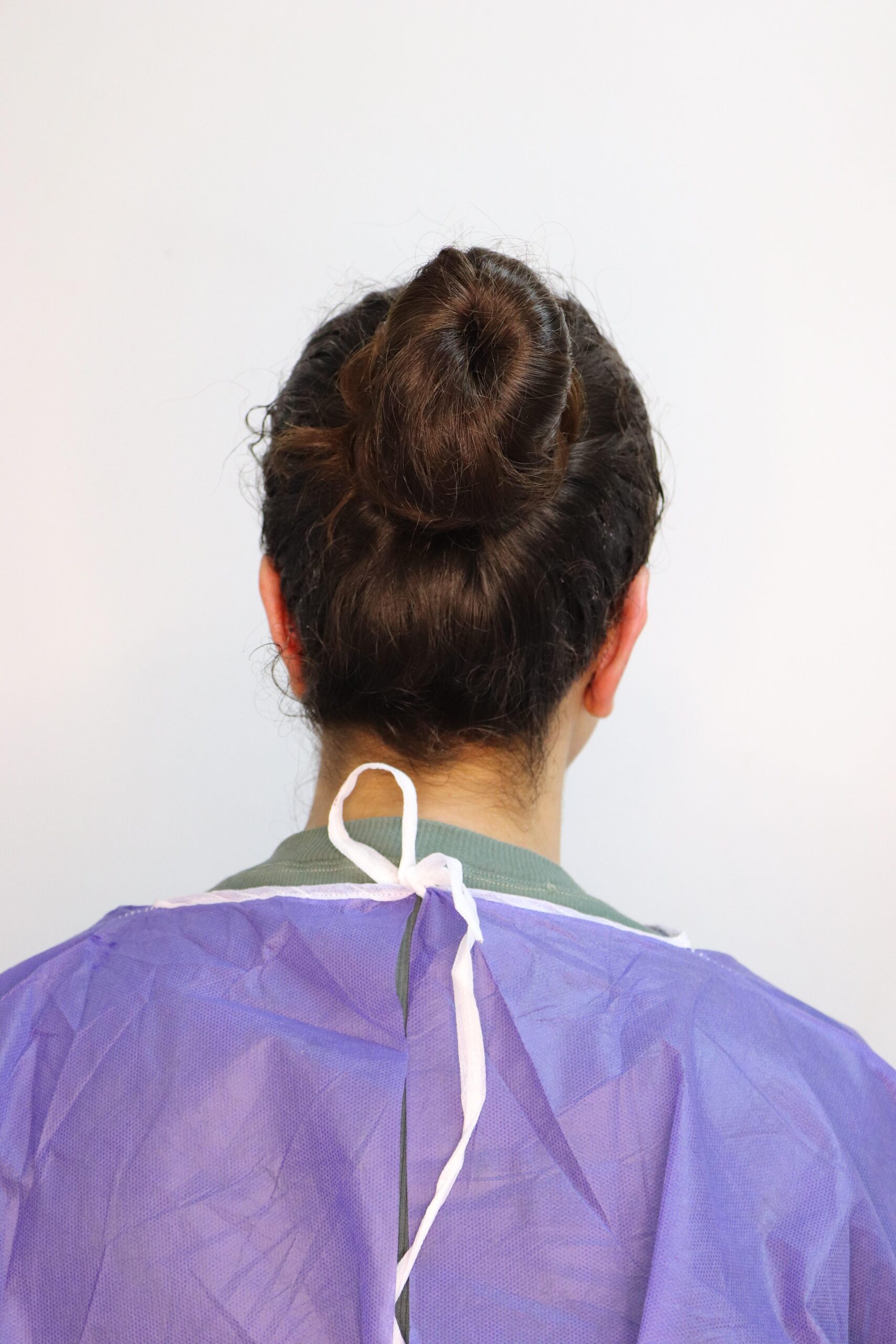 جراحی زیبایی گوش بعد از عمل