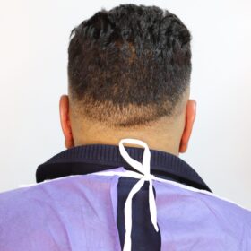 جراحی زیبایی گوش بعد از عمل 