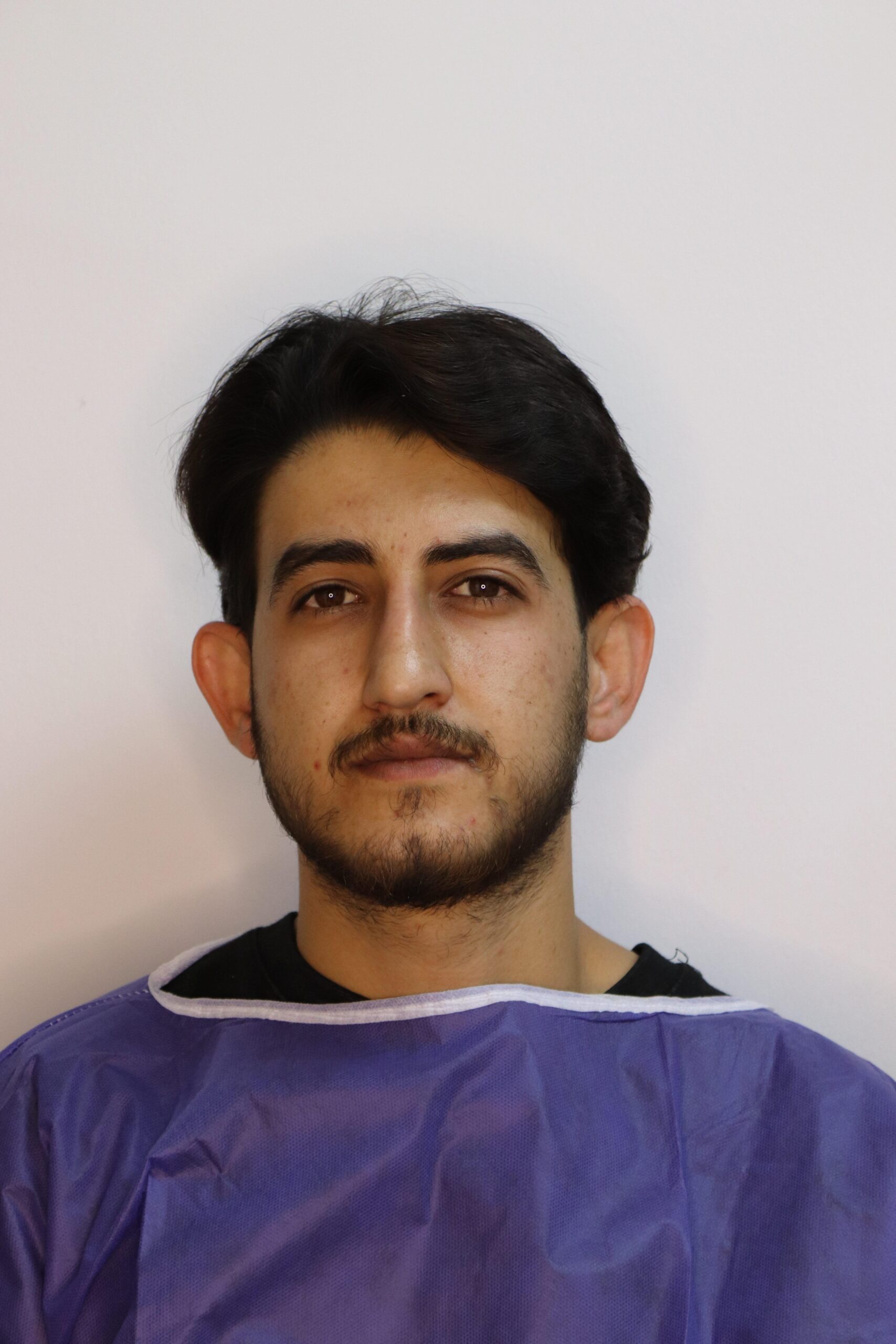 جراحی زیبایی گوش قبل از عمل