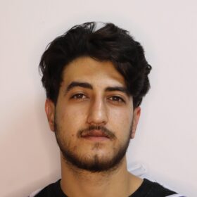 جراحی زیبایی گوش بعد از عمل 