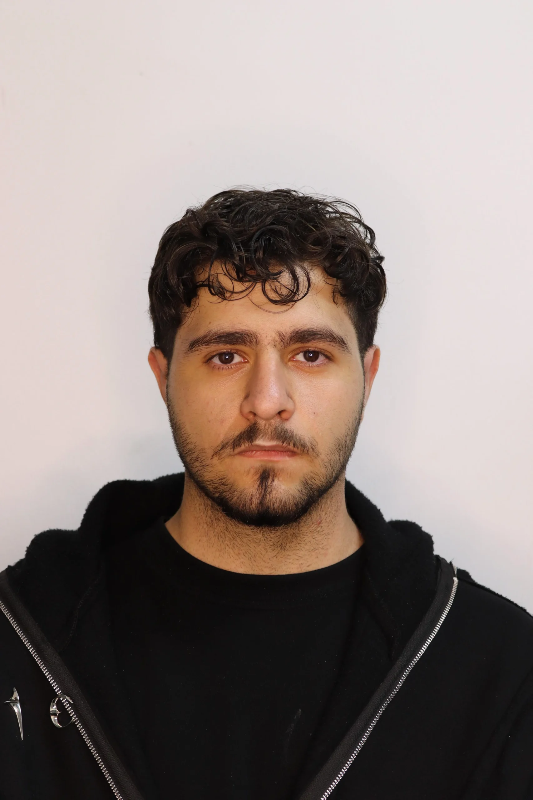 جراحی زیبایی گوش بعد از عمل