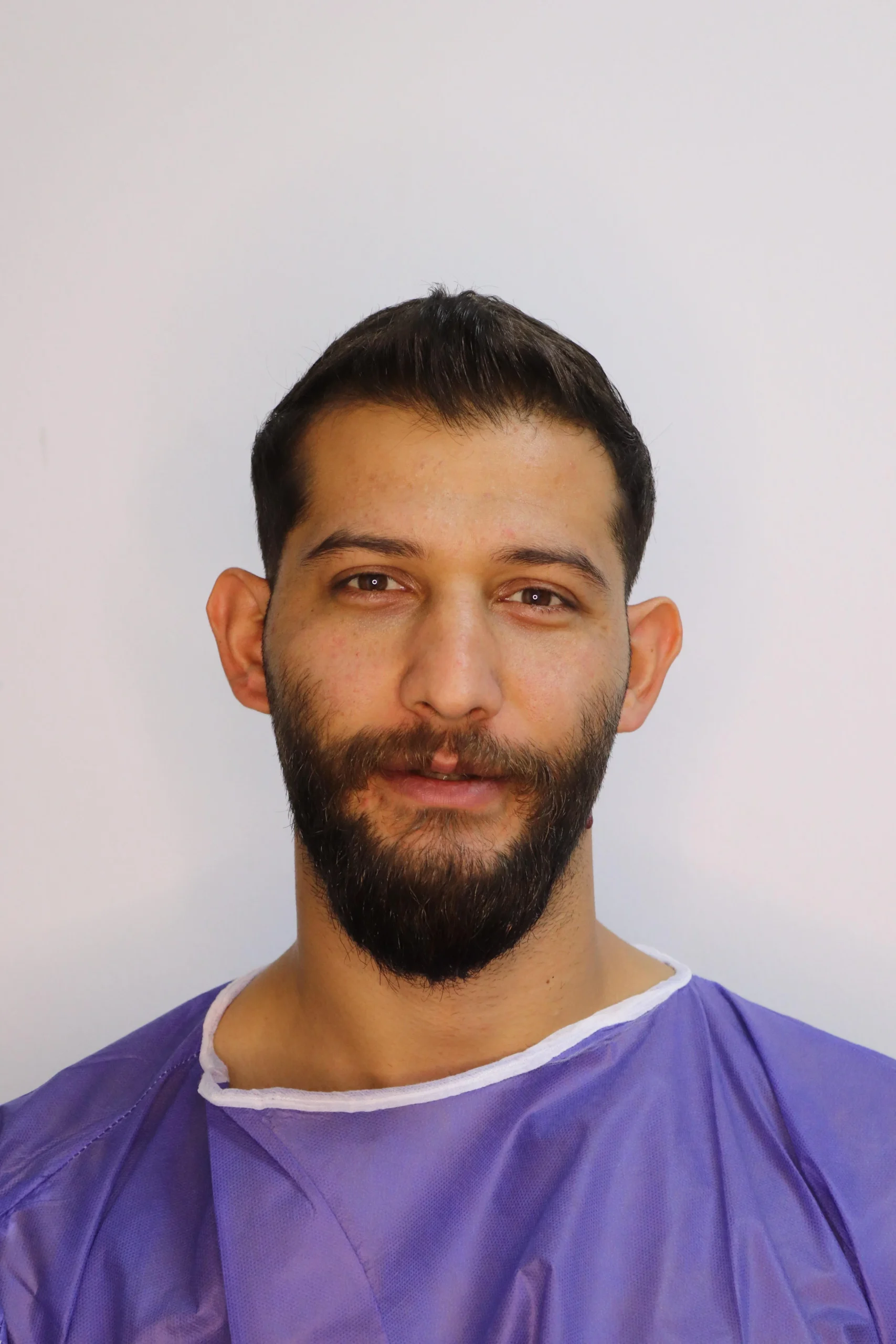 جراحی زیبایی گوش قبل از عمل